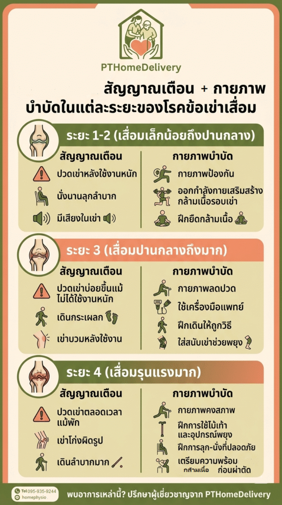  ระยะของโรคข้อเข่าเสื่อม 4 ระยะ
